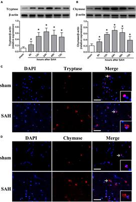 Mast Cells Mediate Inflammatory Injury and Aggravate Neurological Impairment in Experimental Subarachnoid Hemorrhage Through Microglial PAR-2 Pathway